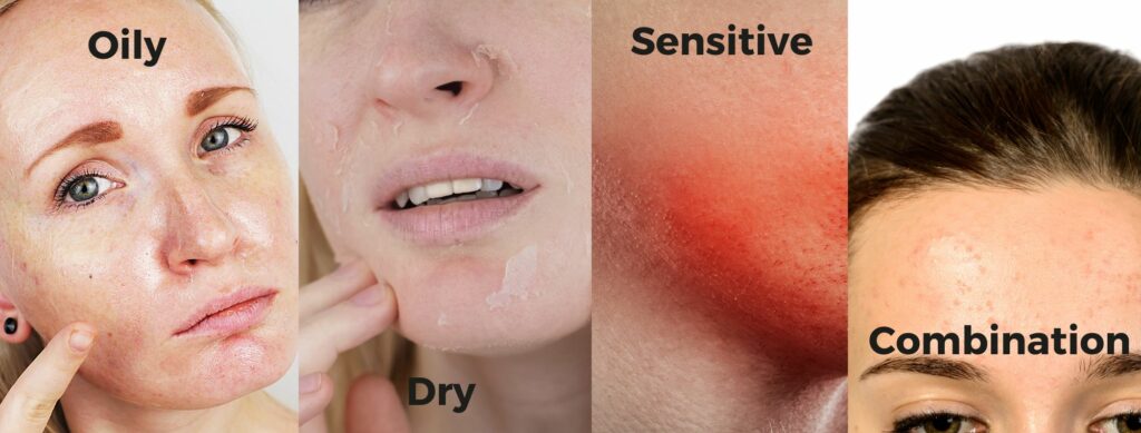 راهنمای مراقبت پوست بر اساس نوع پوست